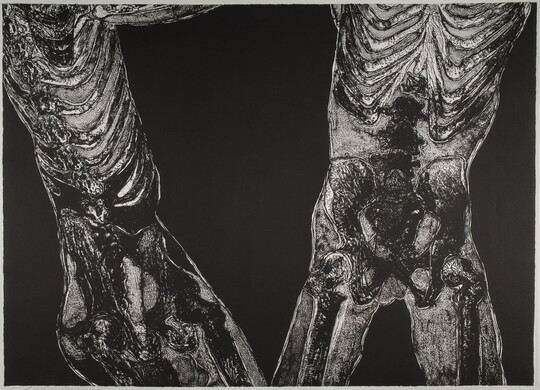 A black-and-white print of two X-ray style bodies, one a front view and one a side view, from mid-torso to mid-thigh.