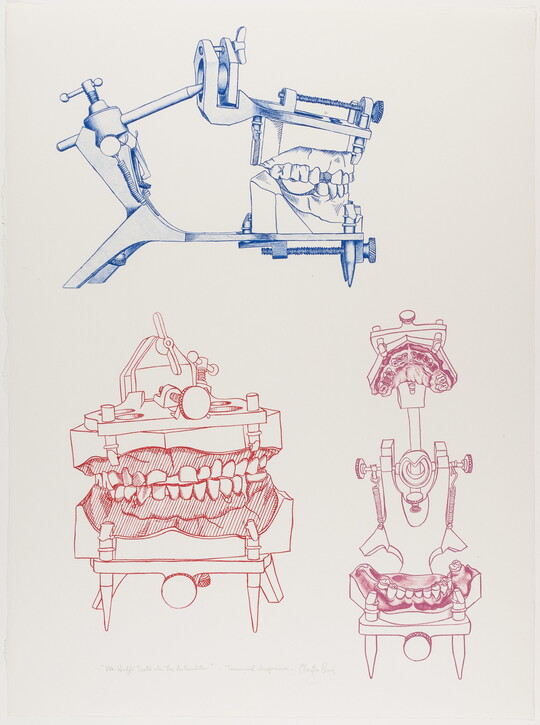 A color print of three sets of dental casts, two red and one blue, in a hinged mechanical device to show various perspectives.