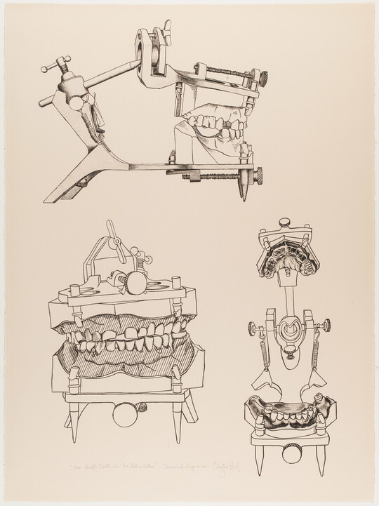 A black-and-white print of three sets of dental casts in a hinged mechanical device to show various perspectives.