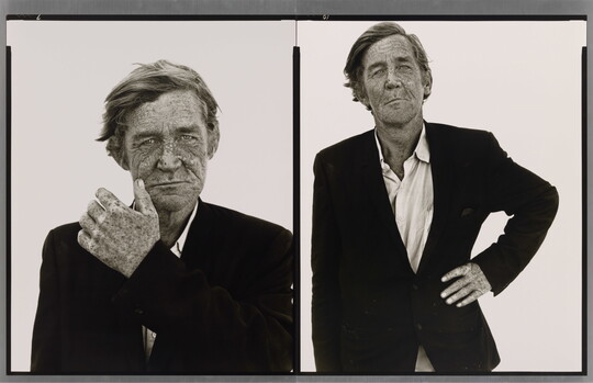 Two side-by-side black-and-white portrait photographs of a White man with a weathered, freckled face wearing a suit jacket; in the left photo he holds a hand to his face and in the other his hand is on his hip.