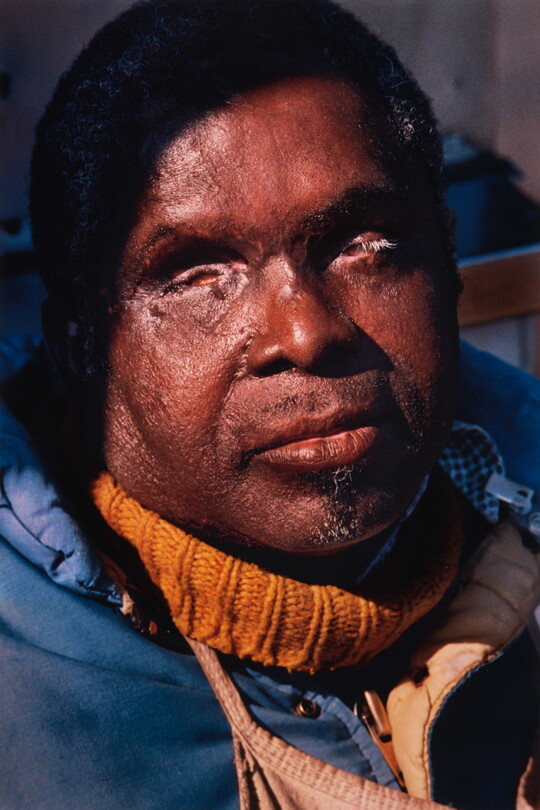 A color portrait photograph of a Black man with no eyes, top of his head in shadow, soul patch on his chin, wearing a yellow turtleneck sweater under a blue coat.