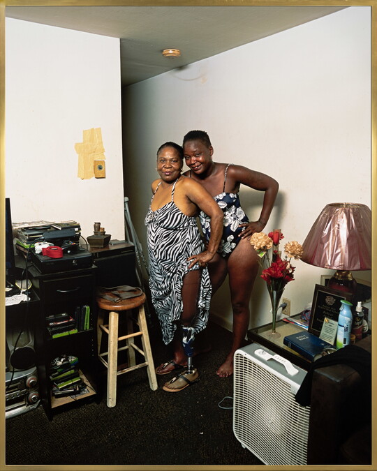A color photograph of an older Black woman wearing a zebra-print dress that she is holding up to show her prosthetic leg standing next to another Black woman behind her wearing a black-and-white bathing suit.