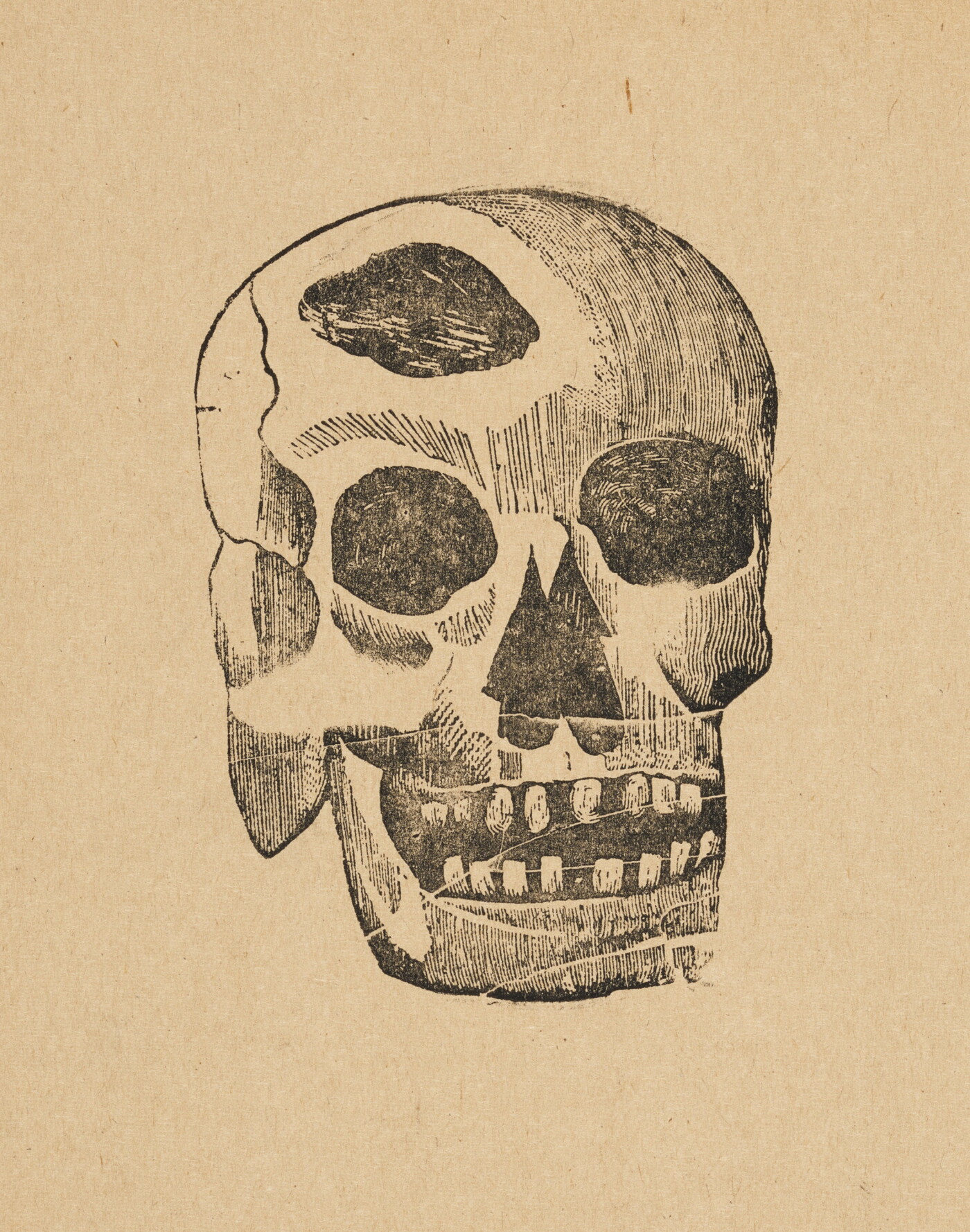 A sepia-toned print of an illustration of a human skull showing a piece missing from the top.