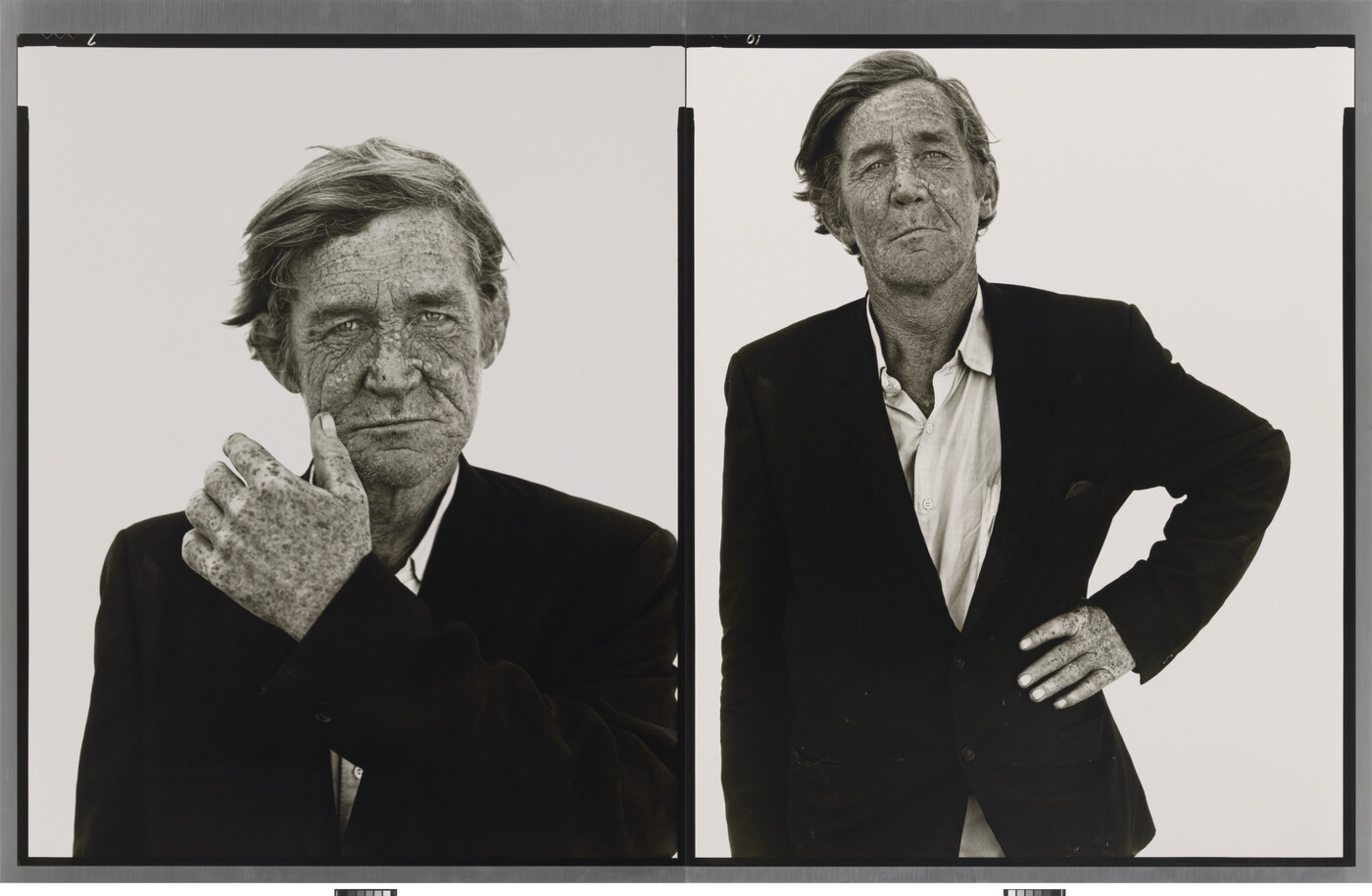 Two side-by-side black-and-white portrait photographs of a White man with a weathered, freckled face wearing a suit jacket; in the left photo he holds a hand to his face and in the other his hand is on his hip.