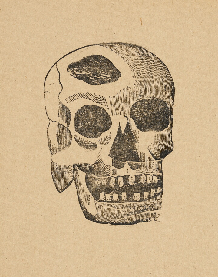 A sepia-toned print of an illustration of a human skull showing a piece missing from the top.