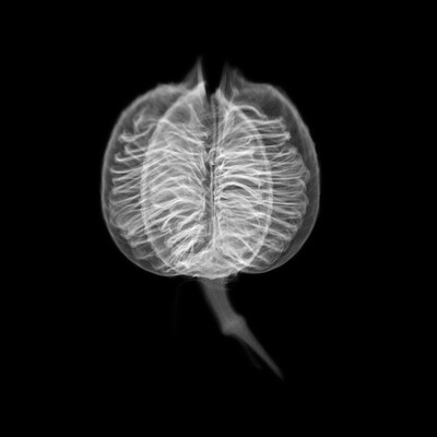 A black-and-white photograph that resembles an X-ray showing the internal structures of a spherical seed.