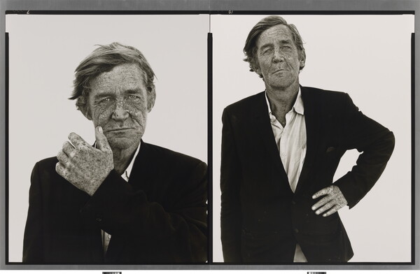 Two side-by-side black-and-white portrait photographs of a White man with a weathered, freckled face wearing a suit jacket; in the left photo he holds a hand to his face and in the other his hand is on his hip.