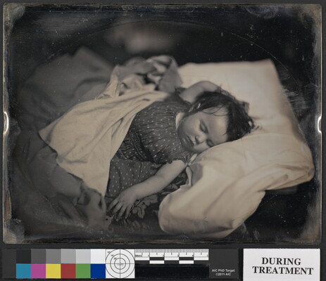 A black-and-white photograph of a White baby sleeping on their back, dark hair sticking to their head, in a bed with one hand above their head and the other at their side.