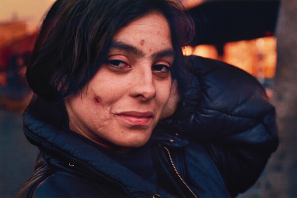 A color portrait photograph of a White person with a pockmarked face and a slight smile, wearing a blue puffer jacket.