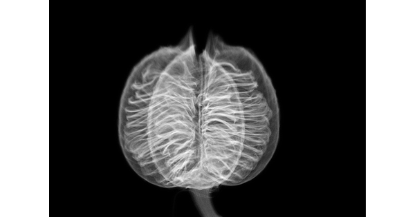 A black-and-white photograph that resembles an X-ray showing the internal structures of a spherical seed.