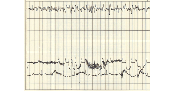 A graph showing three lines with many sharp ups and downs.
