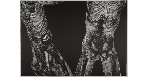 A black-and-white print of two X-ray style bodies, one a front view and one a side view, from mid-torso to mid-thigh.