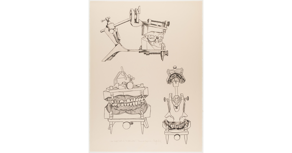 A black-and-white print of three sets of dental casts in a hinged mechanical device to show various perspectives.