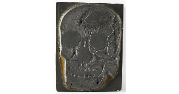 An engraved metal printing plate of an illustration of a human skull showing a piece missing from the top.