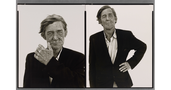 Two side-by-side black-and-white portrait photographs of a White man with a weathered, freckled face wearing a suit jacket; in the left photo he holds a hand to his face and in the other his hand is on his hip.