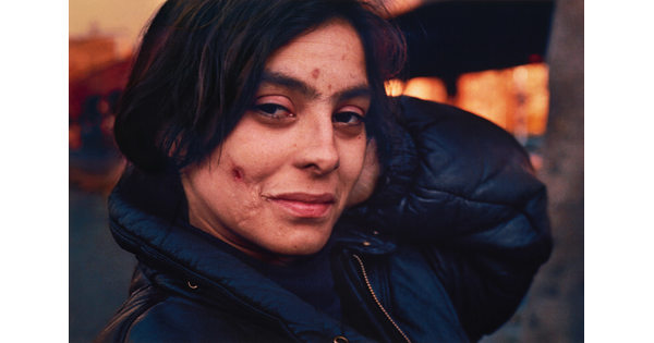 A color portrait photograph of a White person with a pockmarked face and a slight smile, wearing a blue puffer jacket.