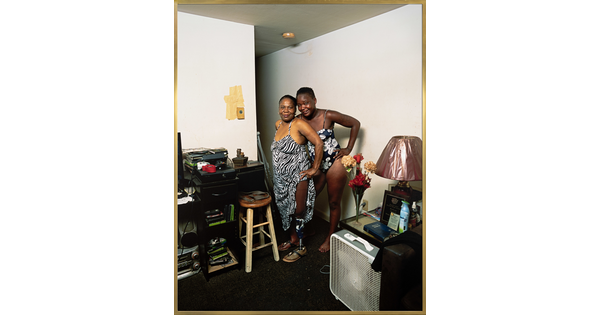 A color photograph of an older Black woman wearing a zebra-print dress that she is holding up to show her prosthetic leg standing next to another Black woman behind her wearing a black-and-white bathing suit.